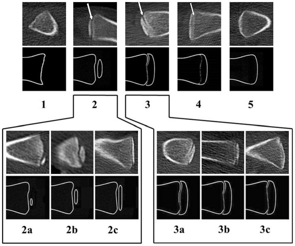 Iconographie clavicules